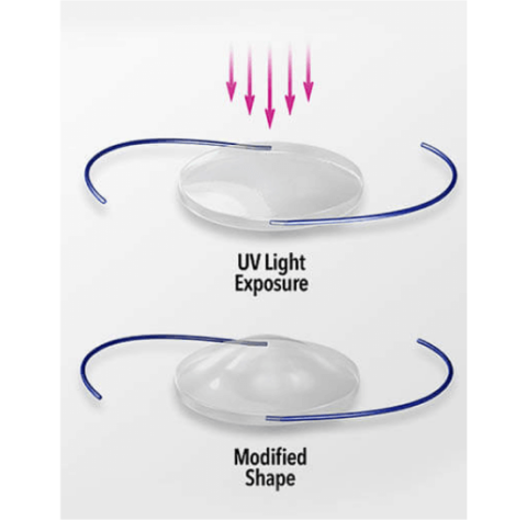 VisionLOCK Adjustment Centers | Postoperative LAL Adjustments